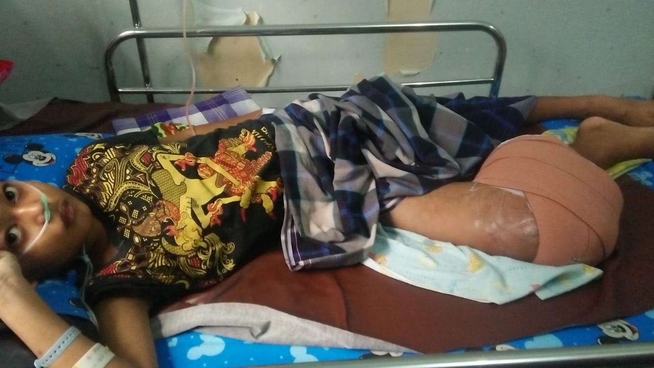 Aryo Warga Desa Bojanegara Yang Terenggut Masa Bermainya Karna Tumor G